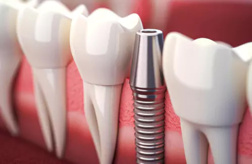 TMJ Jaw Pain Assessment